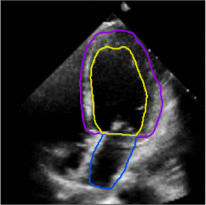 Left ventricle and atrial segmentation for four chamber echocardiography